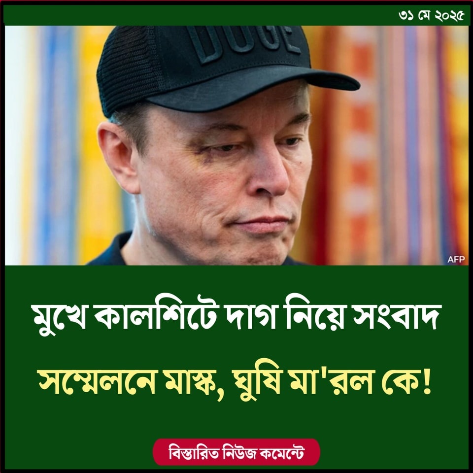মুখে কালশিটে দাগ নিয়ে সংবাদ সম্মেলনে মাস্ক, ঘুষি মারল কে!