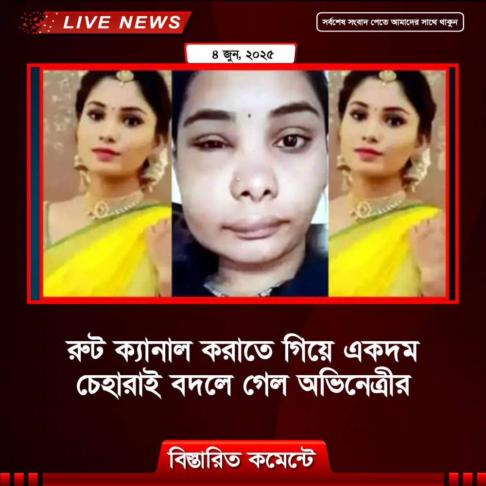 রুট ক্যানাল করাতে গিয়ে একদম চেহারাই বদলে গেল অভিনেত্রীর