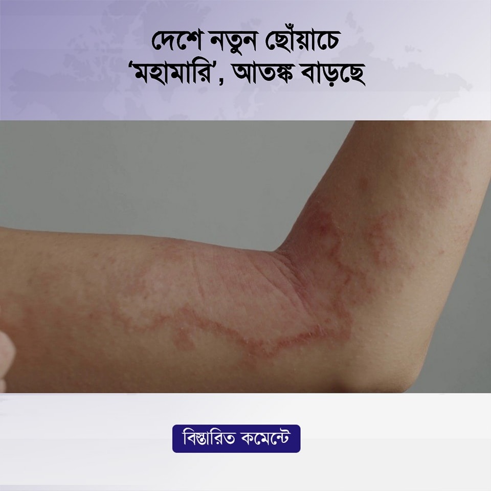 দেশে নতুন ছোঁয়াচে ‘মহামারি’, আতঙ্ক বাড়ছে